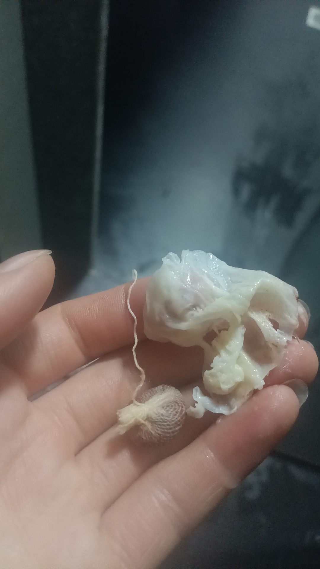 这就是选择相信御淑丹的优势,排毒效果自己亲眼看到见,少花钱,身体