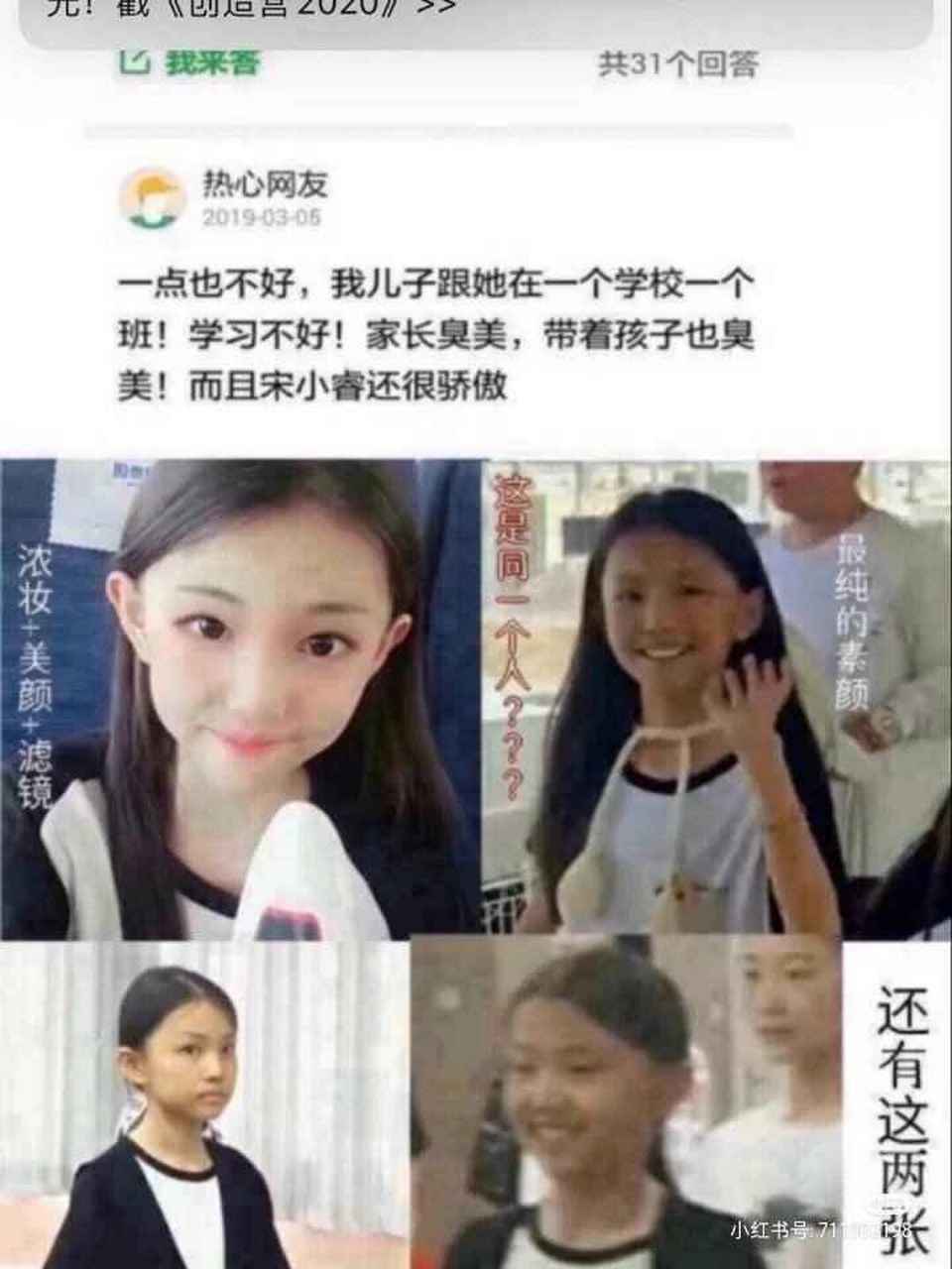 宋咨睿(宋小睿)为什么黑粉这么多