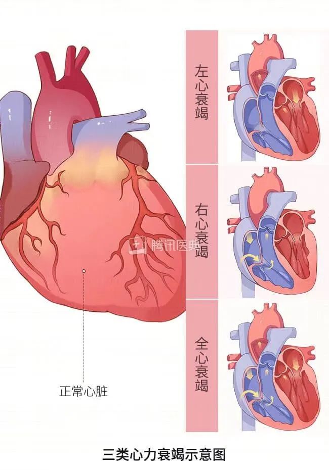 心肌位置图片图片