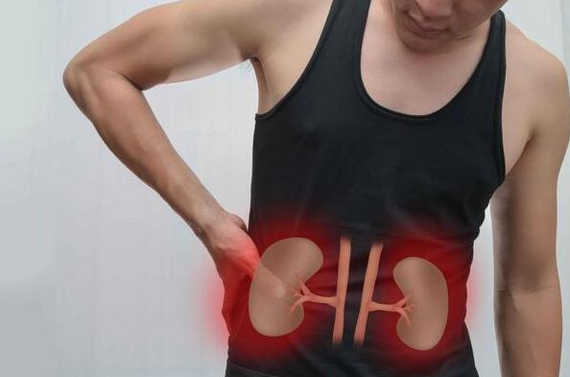 肾结石#肾结石有什么症状#肾结石的症状 一,疼痛,根据结石的大小和