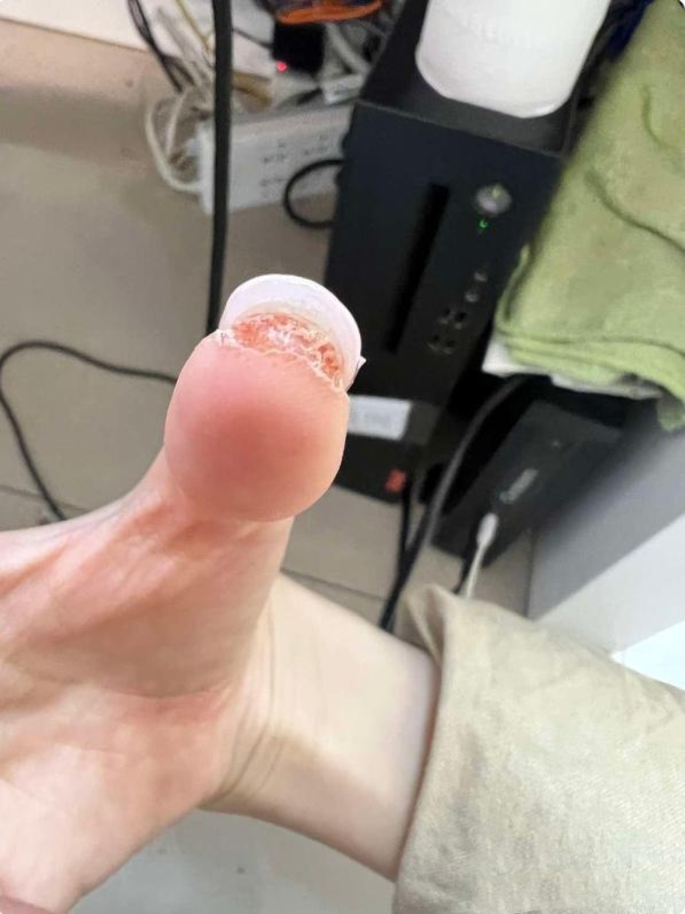 真是欲哭无泪,做个美甲咋还做出问题空手指头空手指图片 吓人空手指