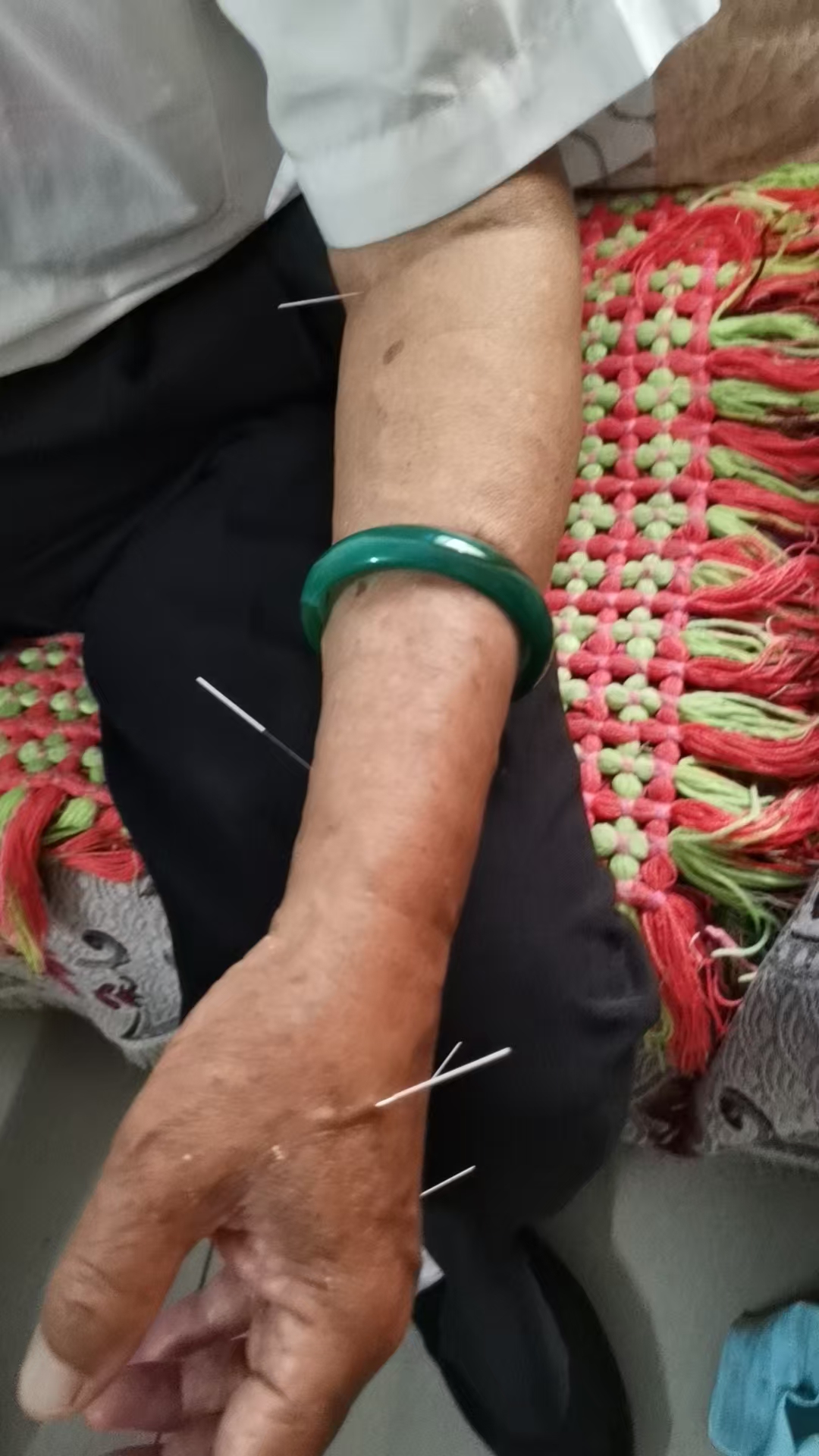 去他家,我立即赶过去,通过诊断,父亲是心神问题, 于是立即给他针灸