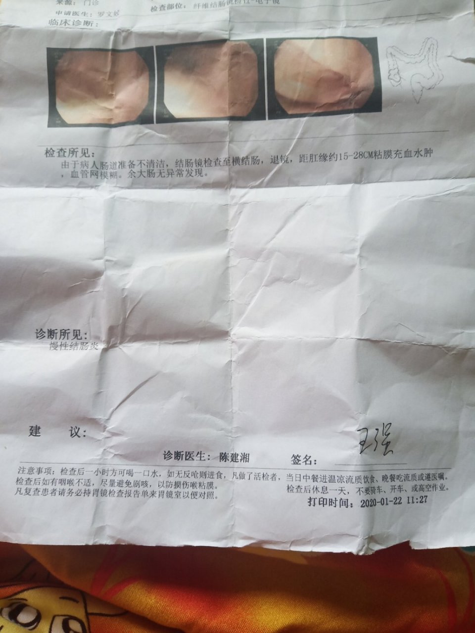 距肛缘约15-28cm粘膜充血水肿,血管网模糊(女,31岁),诊断所见:慢性结