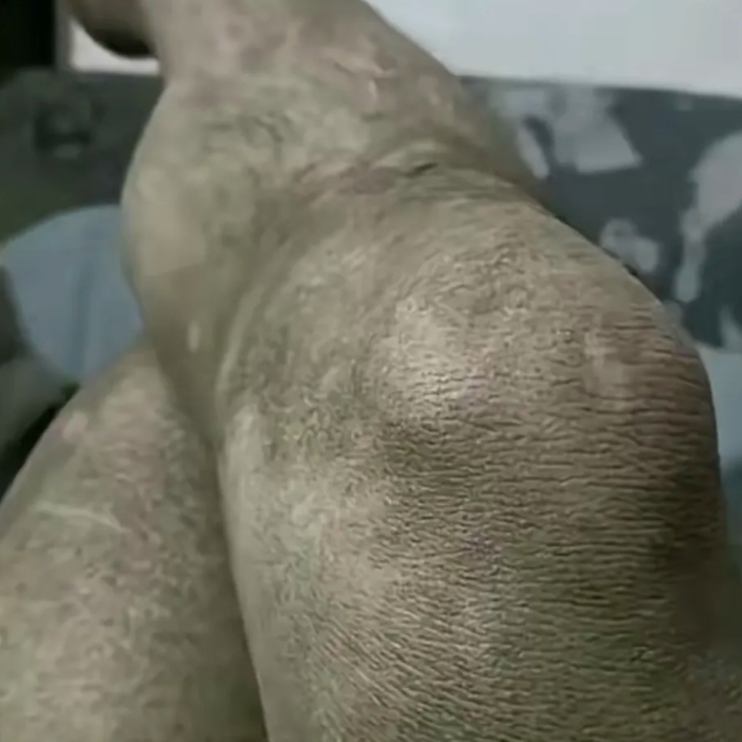 有网友求救,如果咱们的皮肤变成这样了,咱们需要去医院去看哪一科?