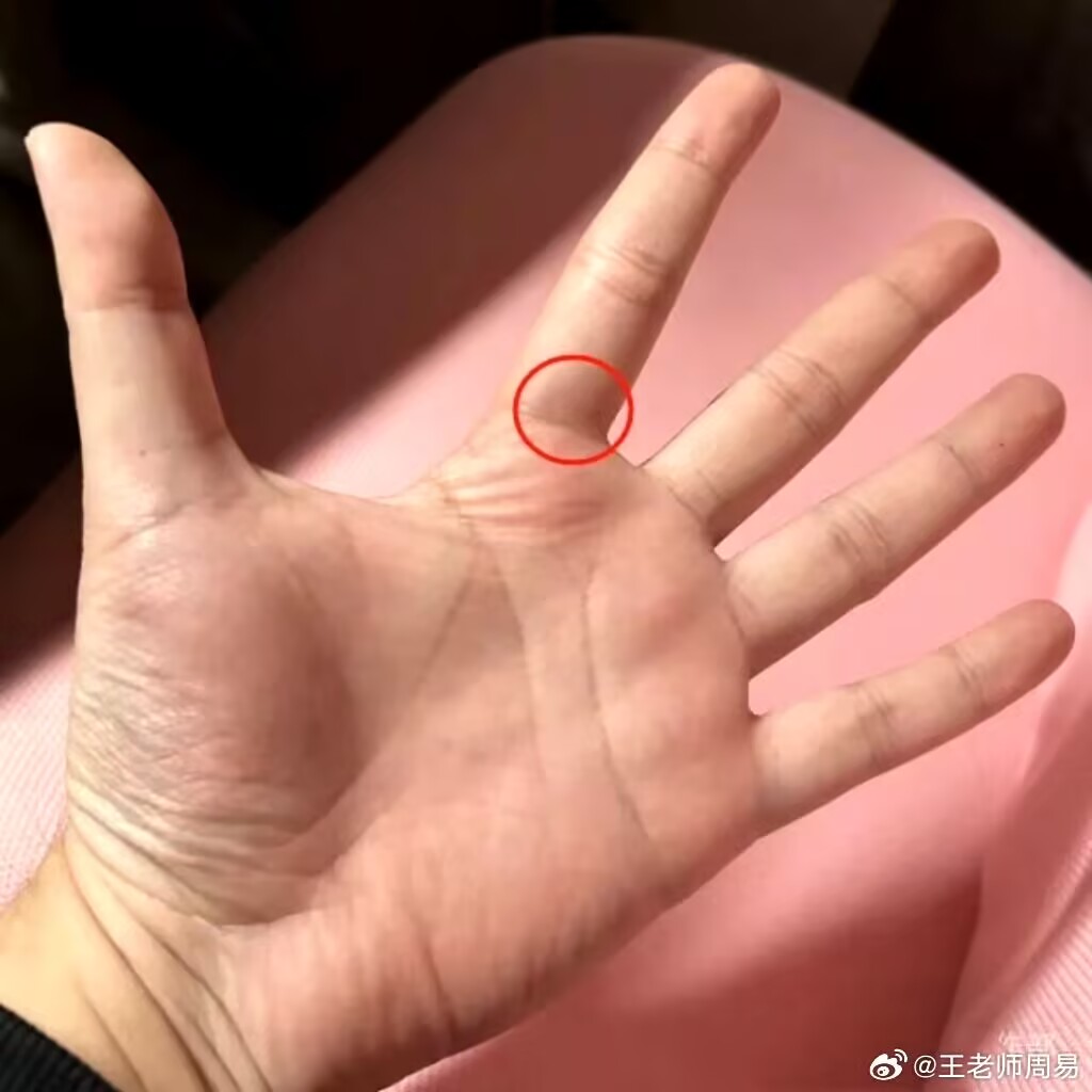 "#中 食指根部位置图右手食指根疼食指根部图片食指脉络正常图片大全