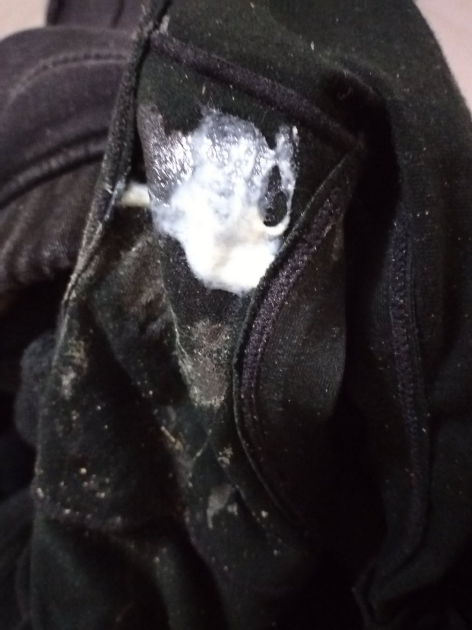 没事有内分泌系统排泄出没事干净利落排毒养颜没事液体健康乳白带常规