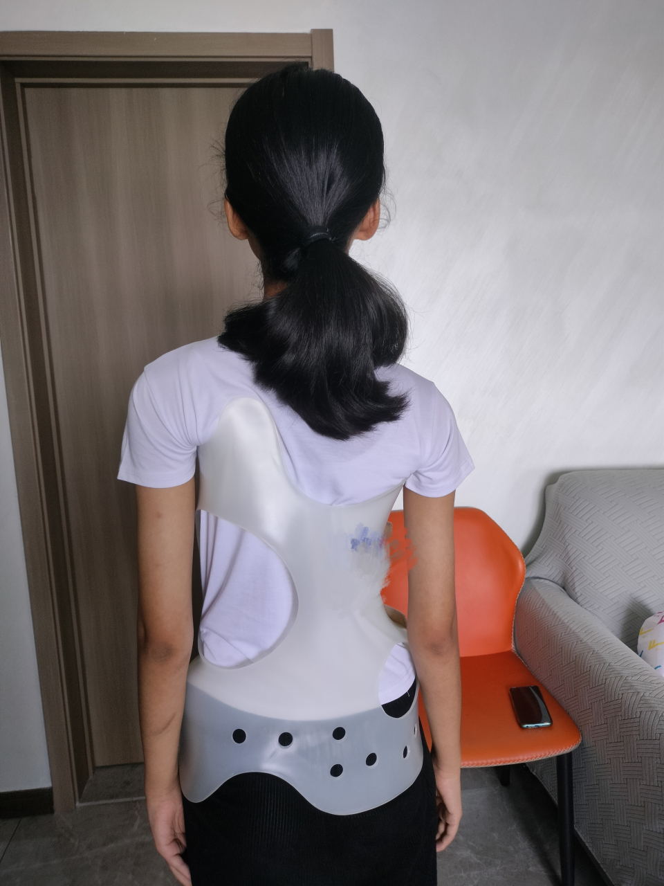想问大家脊椎侧弯除了戴支具还有什么方法治疗吗?#暑假