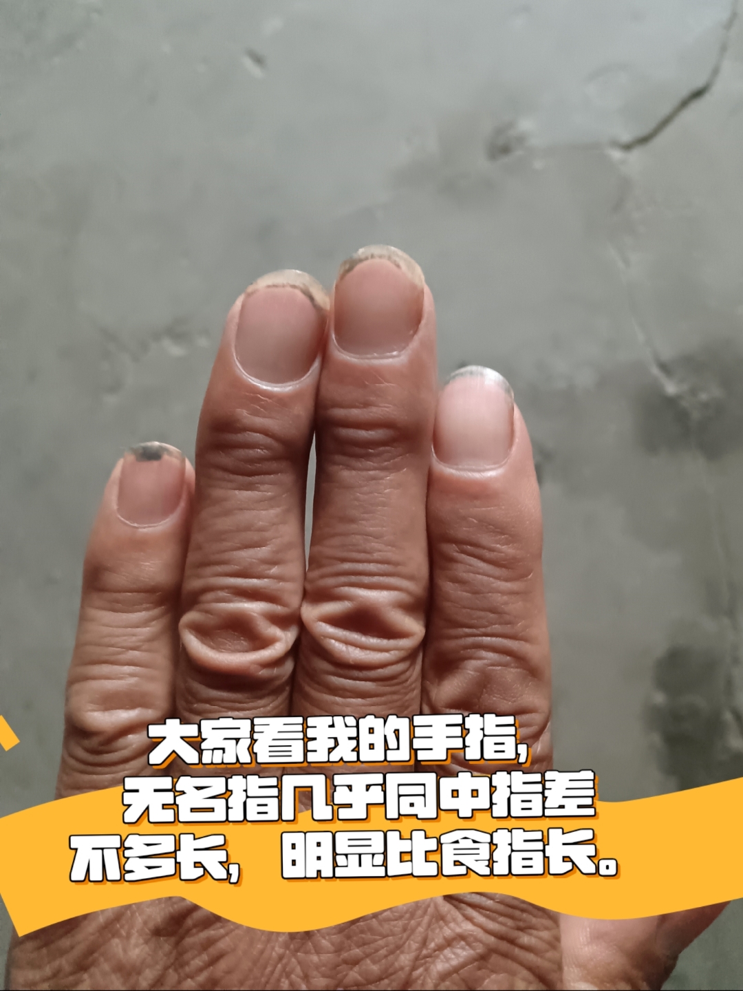 无名指比食指长,与中指长度相近,手指比例显独特