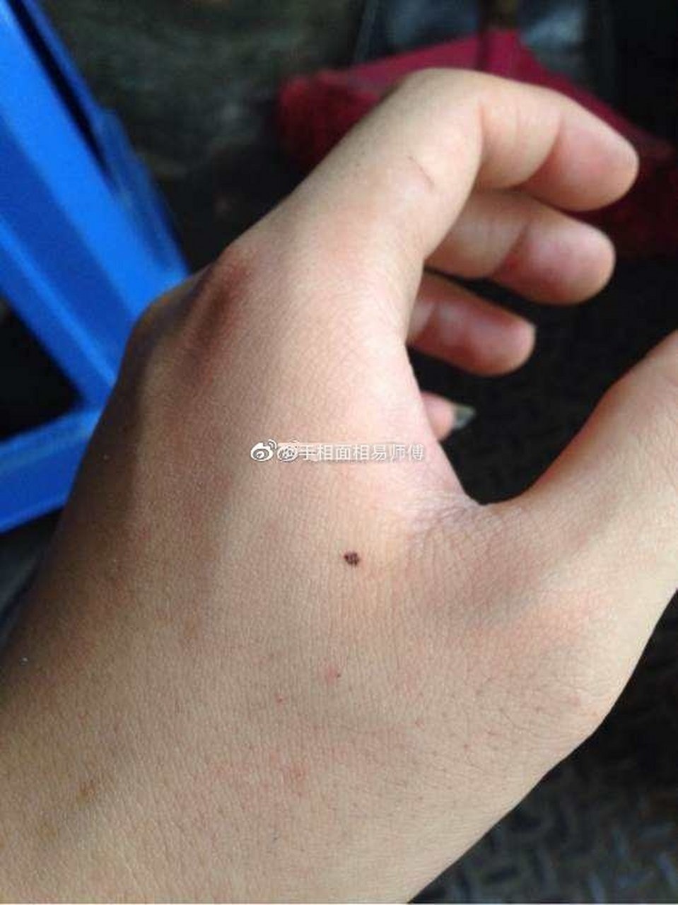 虎口有痣代表什么 这个位置长痣主忧思,有这种痣相的人,心思缜密内心