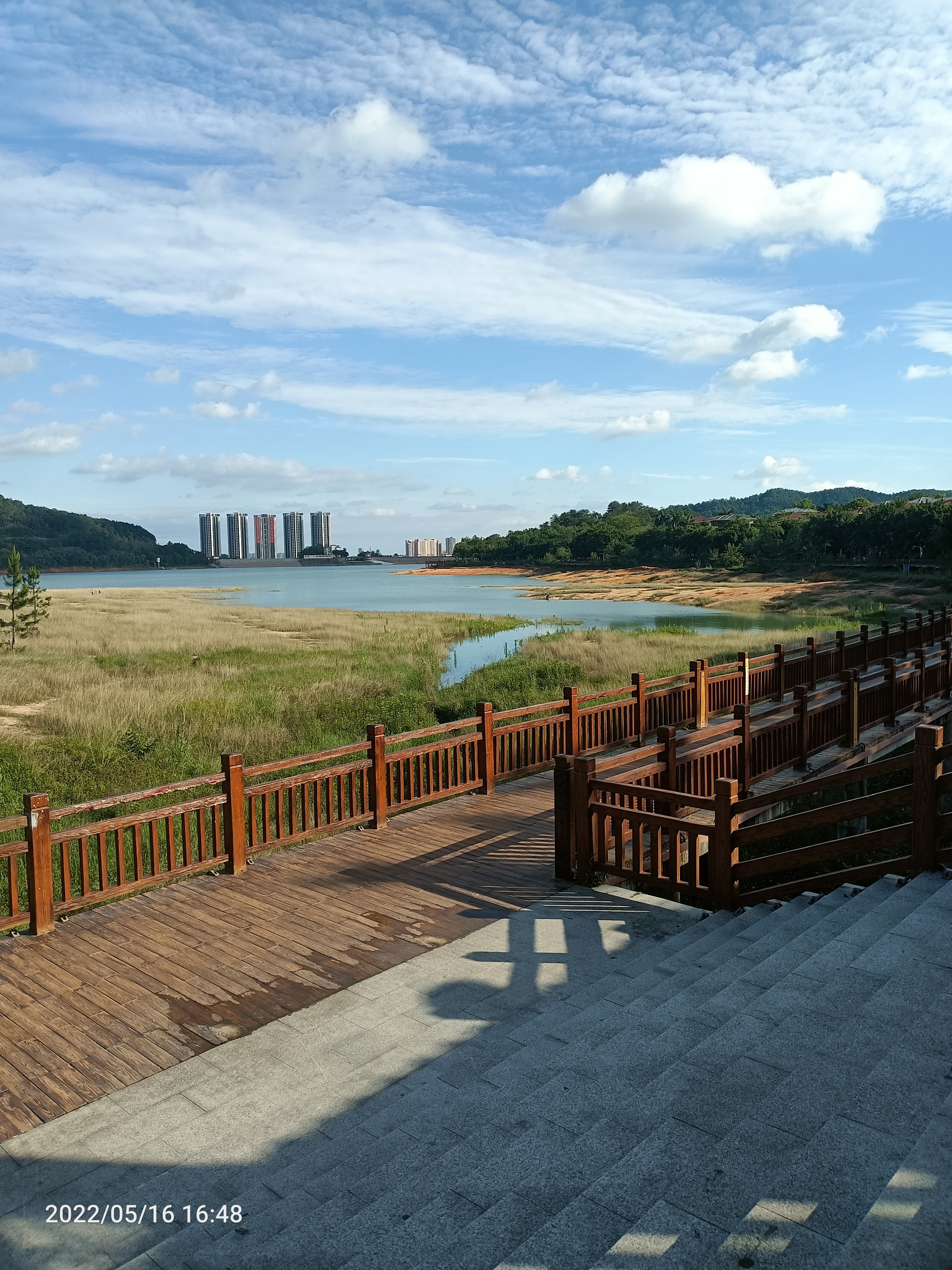 小张的母亲因为病重治住院治疗,住院一个