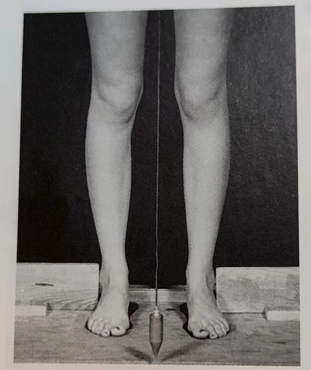 下肢力线:正面第四张 图片上这种女生的腿其实特别特别特别多.