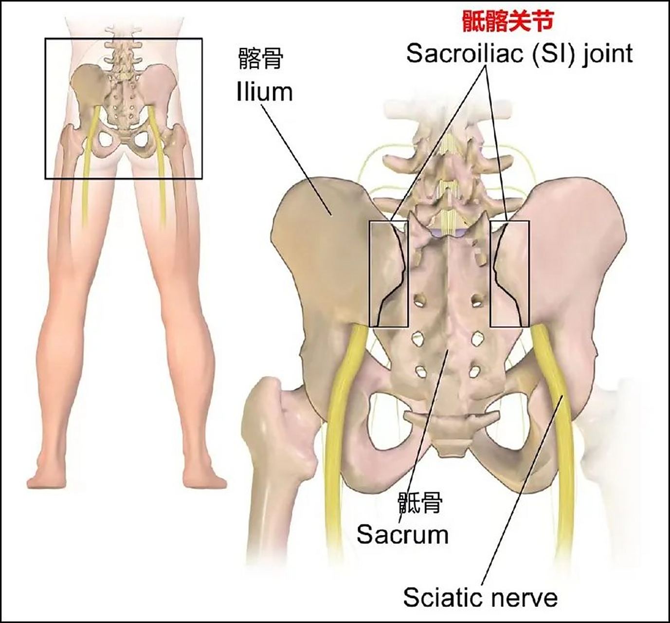 骶髂关节炎——下腰痛的噩梦: 骶髂关节: 骶髂关节是骶骨和髂骨之间的