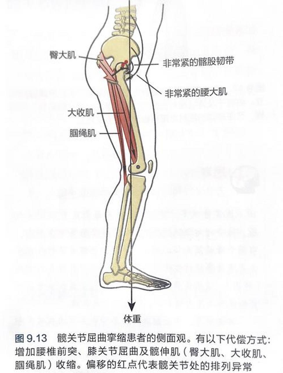 髋关节屈曲挛缩实验(托马斯试验): 用于检查髋关节屈曲挛缩畸形.