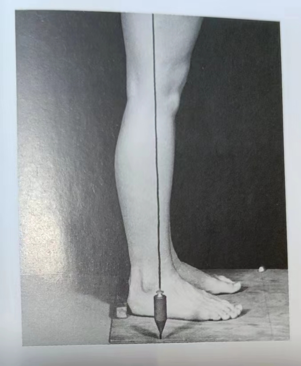 下肢力线:侧面第一张(相对比较良好的膝关节排列) 说这个是相对比较