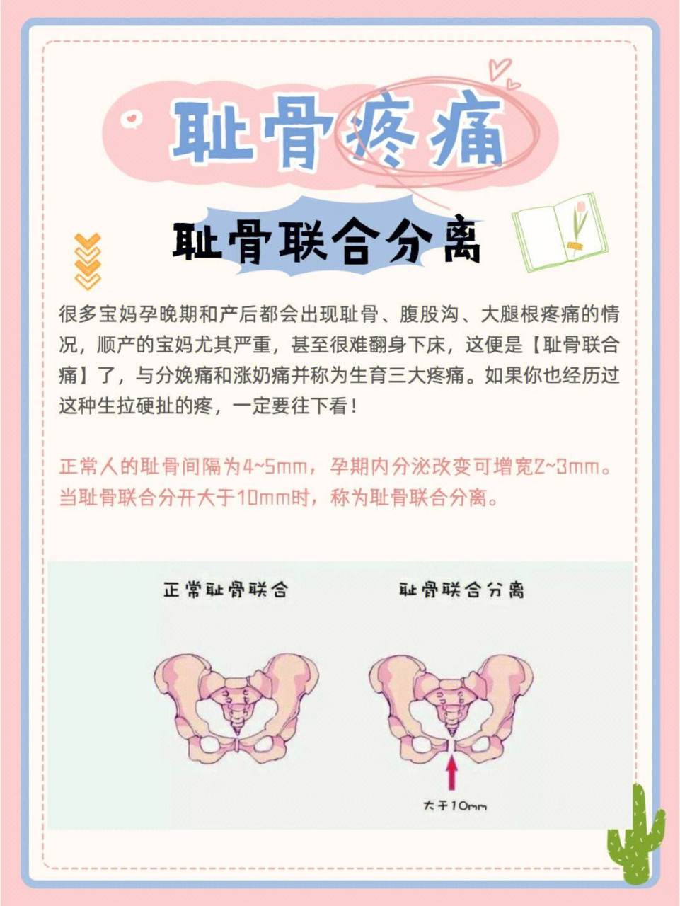 耻骨联合分离疼痛: 产后的妈妈们常常被各种疼痛折磨,坐骨神经痛,肌肉