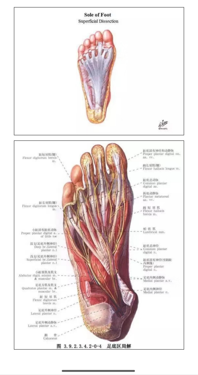 足底筋膜炎解剖图图片