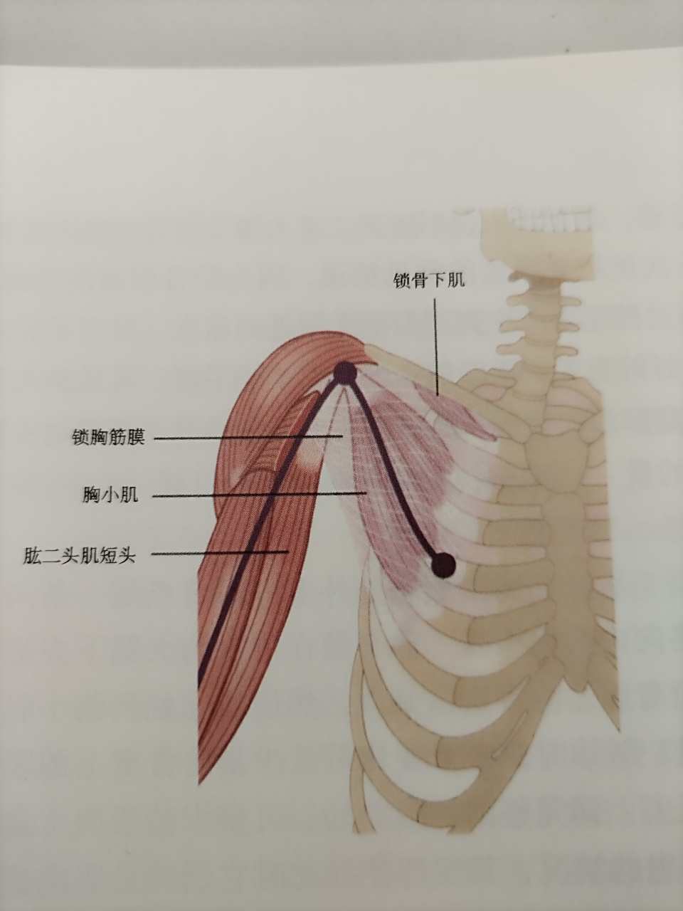 胸小肌	: 胸小肌和胸锁筋膜很难从其上覆盖的胸大肌中找到并进行单独