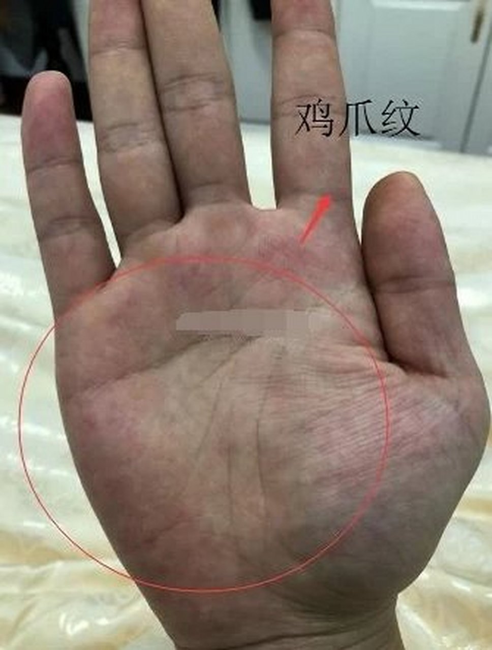 鸡爪纹是三线相连接,这就意味着感情线尾端下滑,情感线尾端是平直的.