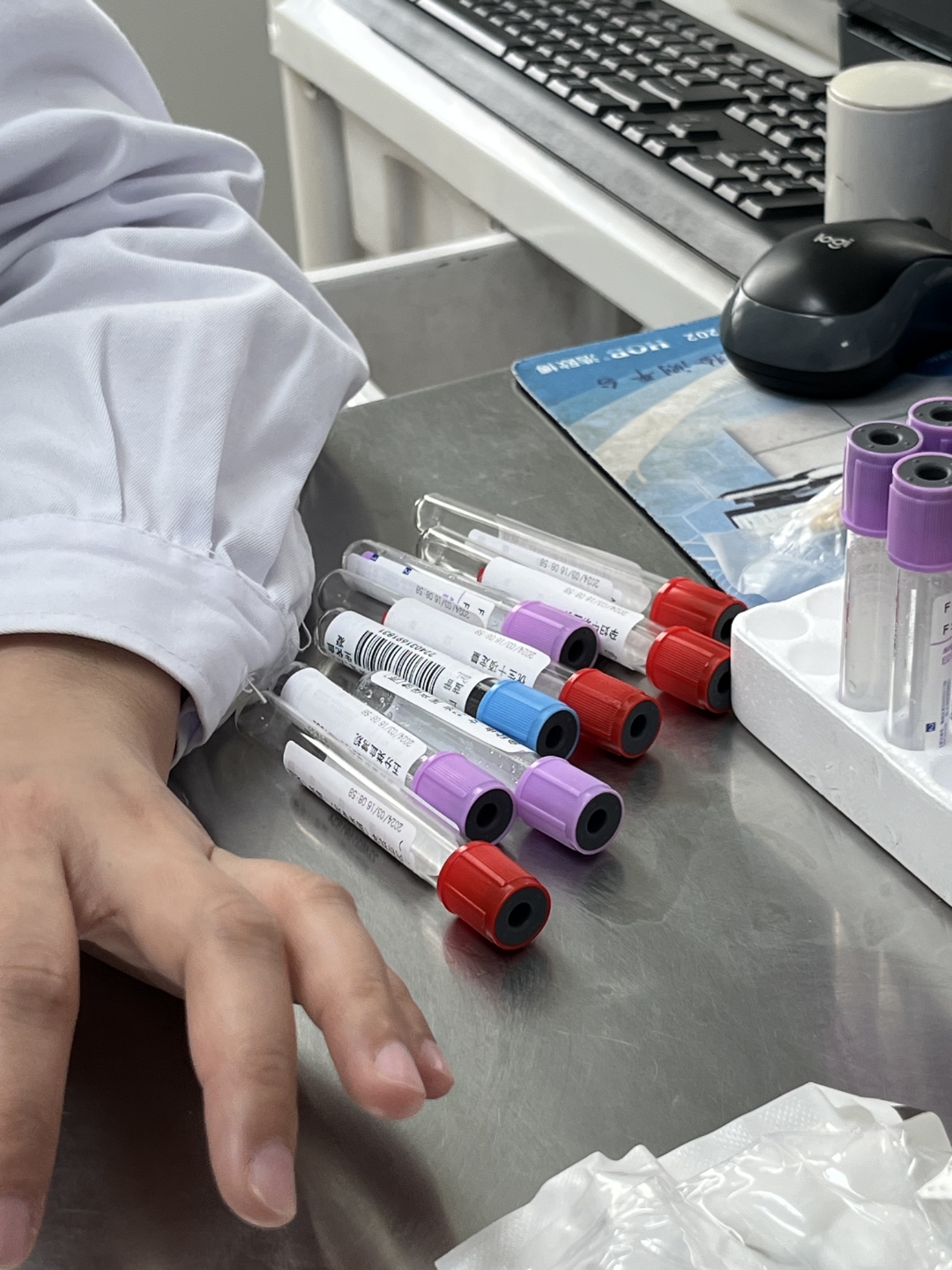 费血抽血管图片胞衬蛋白抗体检测图片抽五管血的图片真实高清抽血dna