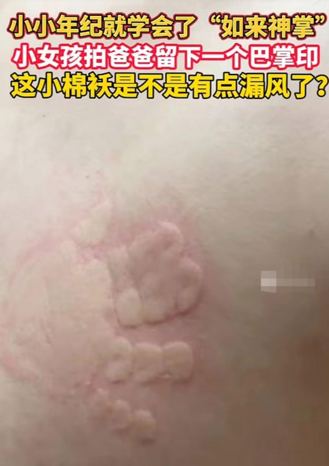 小女孩拍爸爸后背,直接留下一个巴掌印,小手掌萌萌的好可爱,只是她爸