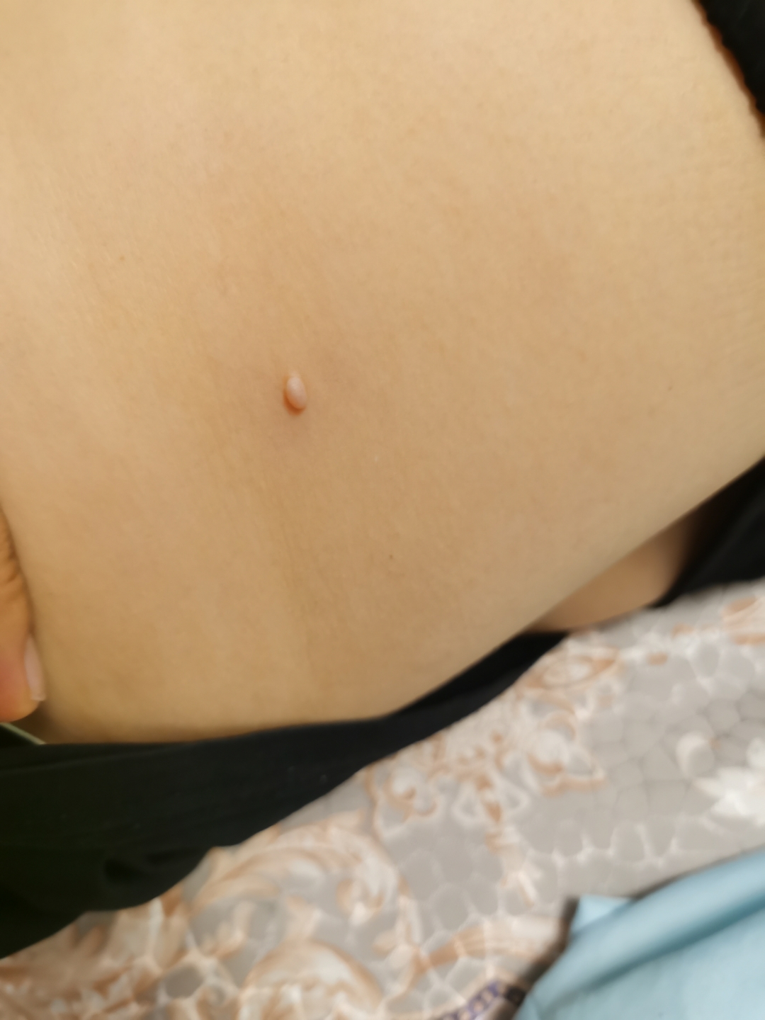 长在腰上的,软软的一个包