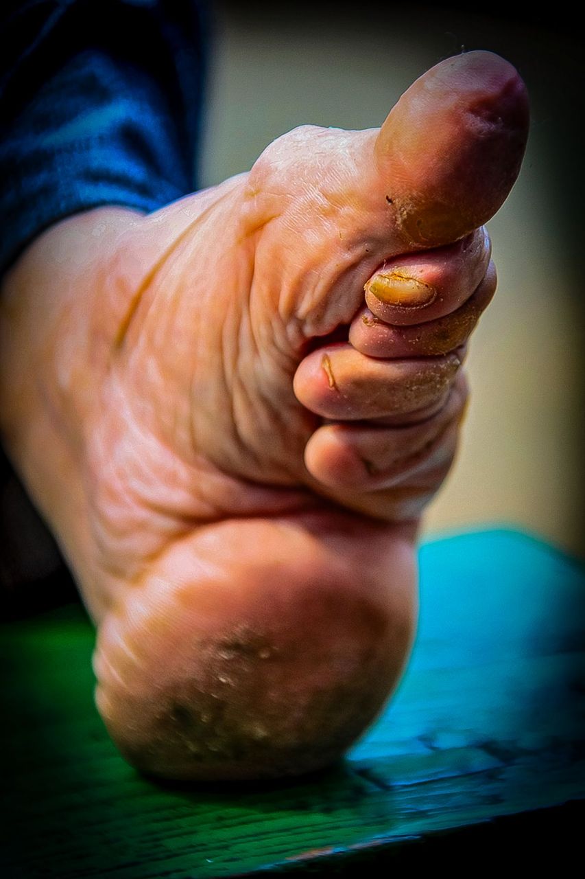 沂蒙山区的小脚母亲 67  还记得奶奶的小脚吗?