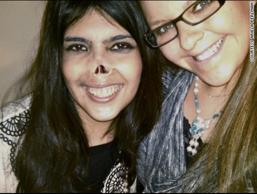 在阿富汗,一位年轻的女孩被丈夫残忍地割去鼻子,这种行为让人痛心疾首