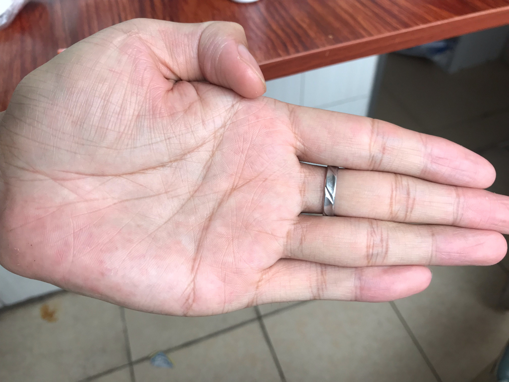 在二十八,二十九岁左右的流年,生命线出现了断开,预示着在二十八