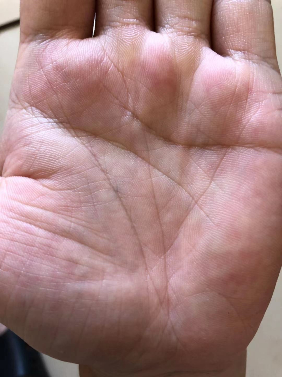 食指根部出现了棺材纹,又有上升线,同时三丘丰隆饱满(水星丘,太阳丘