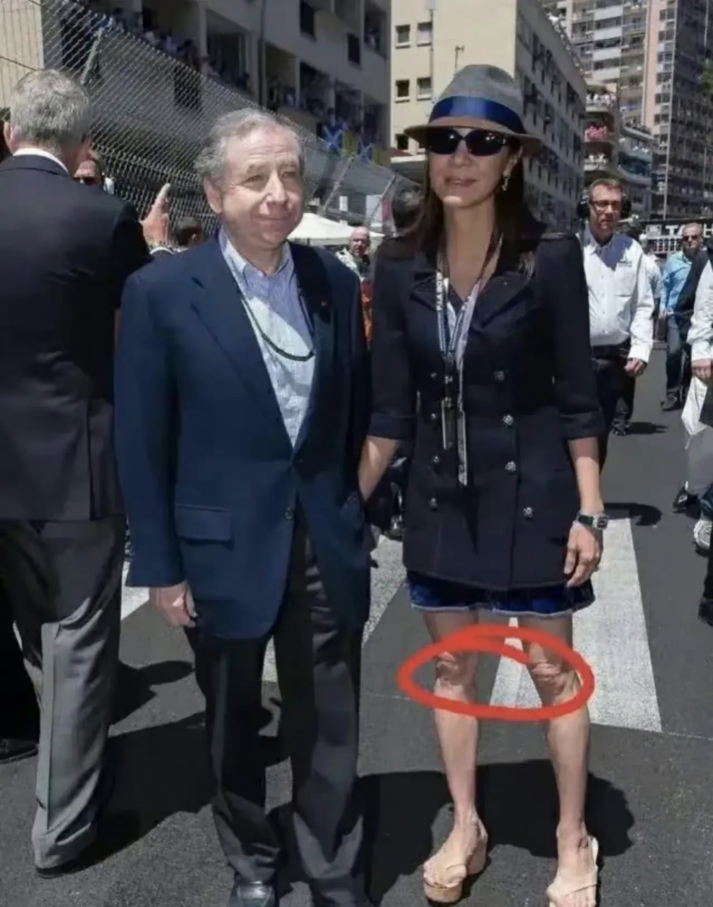 杨紫琼的脚已经严重变形了,脚趾居然外翻成这样,这可能是她这些年拍戏