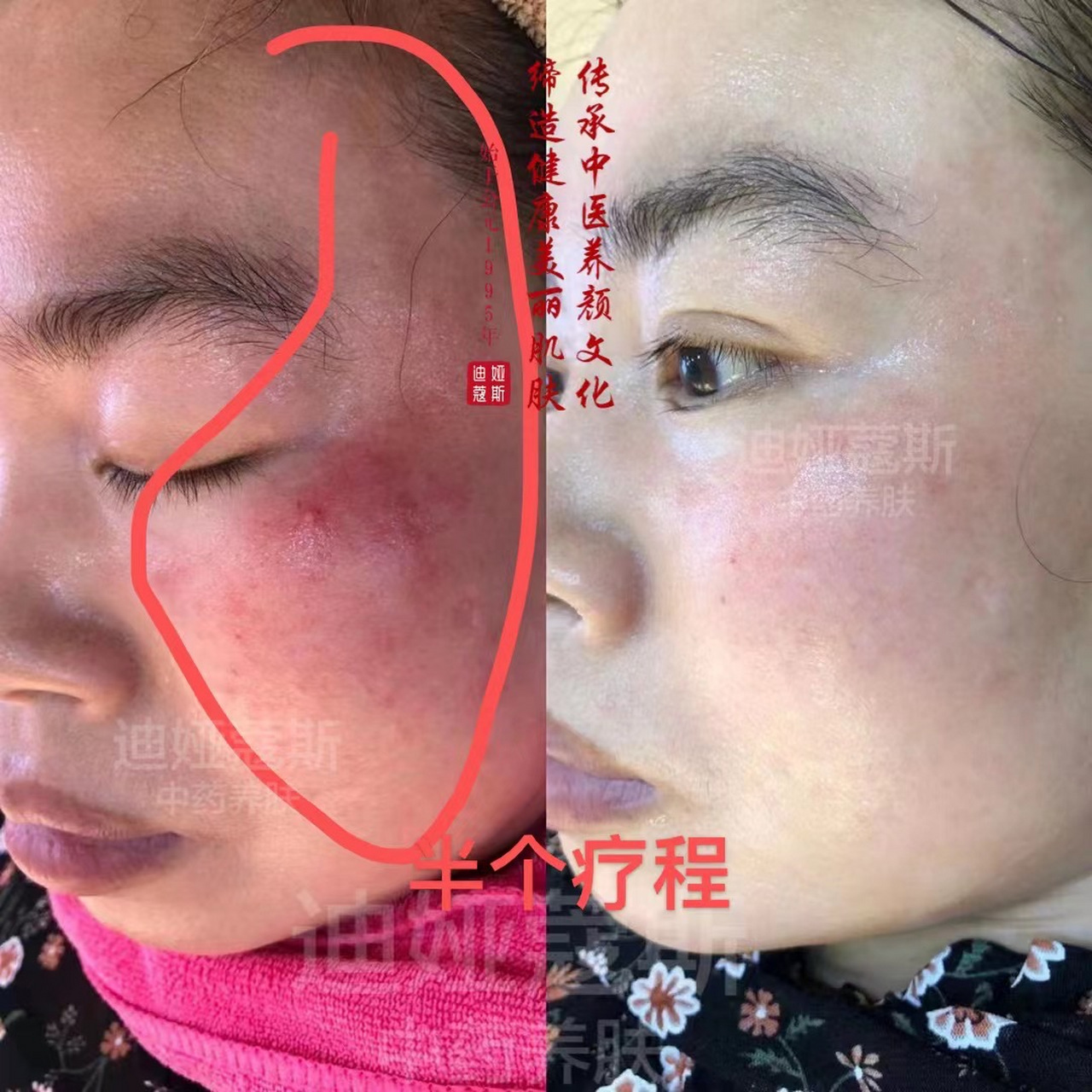 迪娅蔻斯中泥坊 【中泥坊】草本植物面膜的特点 面膜中绝不含任何化学