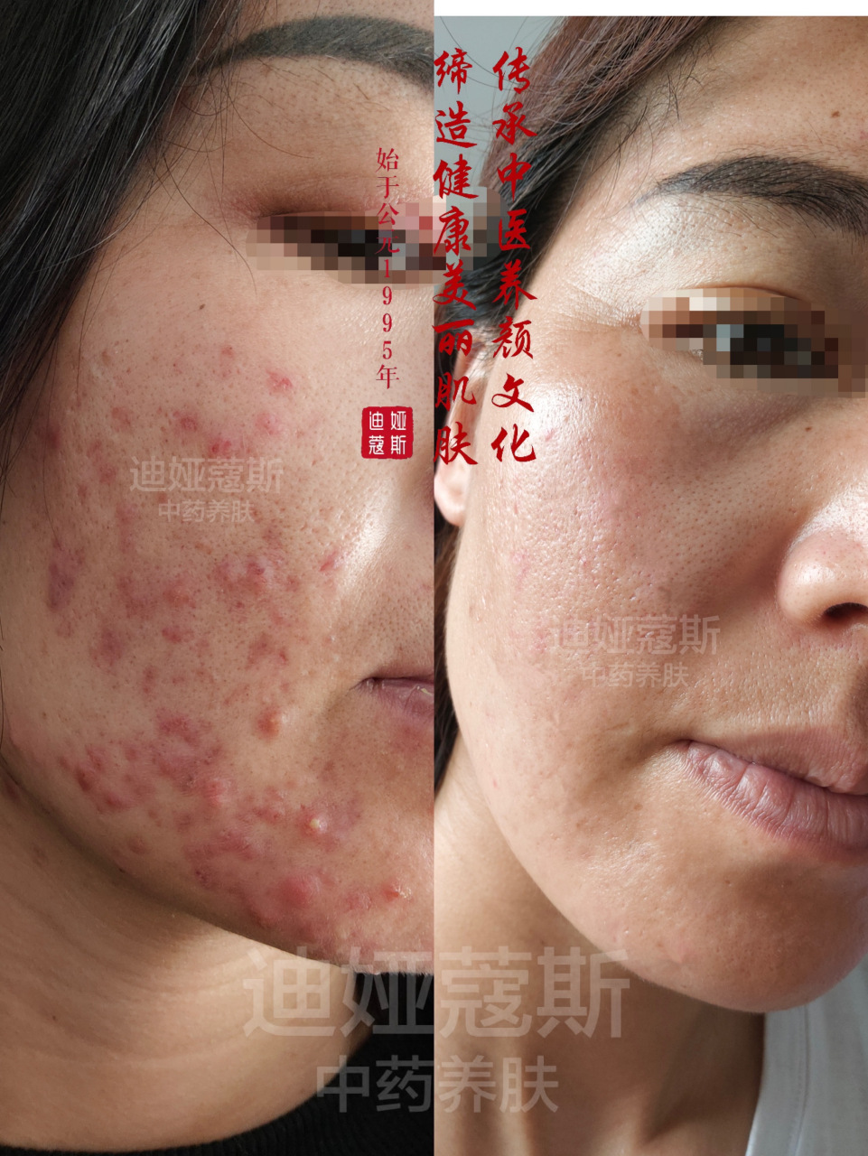 迪娅蔻斯中泥坊 【中泥坊】草本植物面膜的特点 面膜中绝不含任何化学