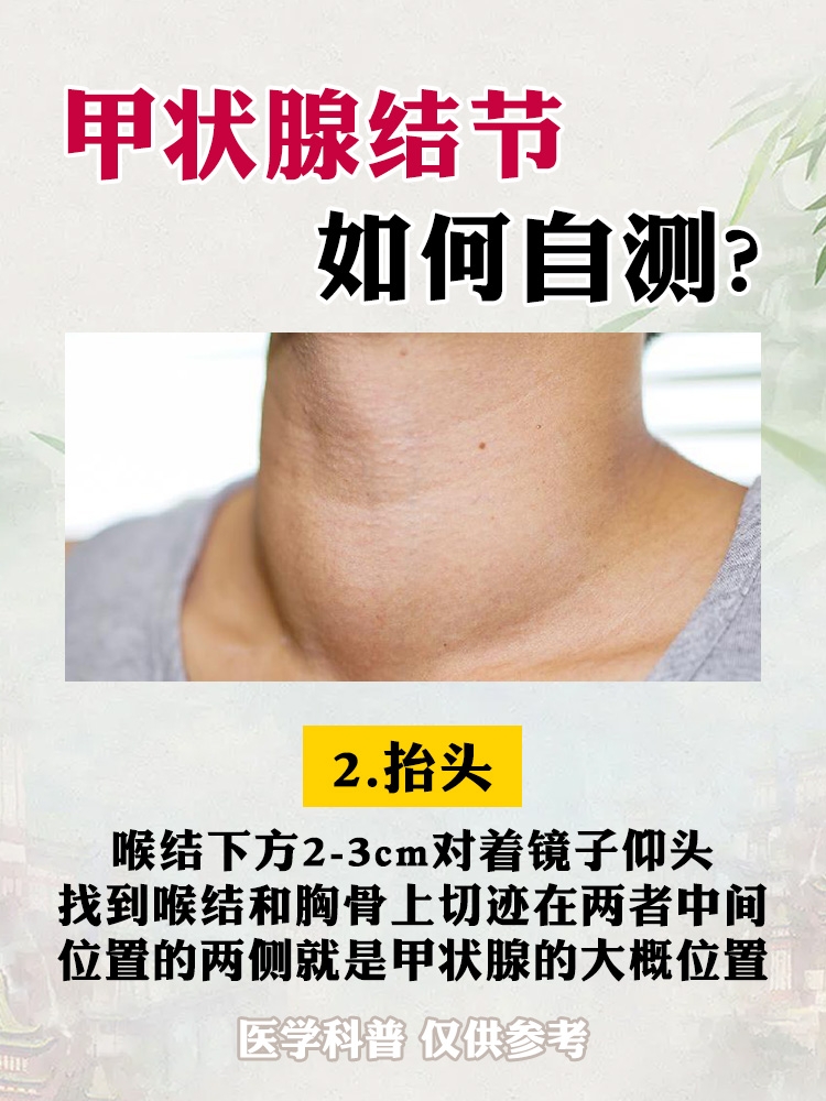 30秒教你学会如何自测甲状腺结节