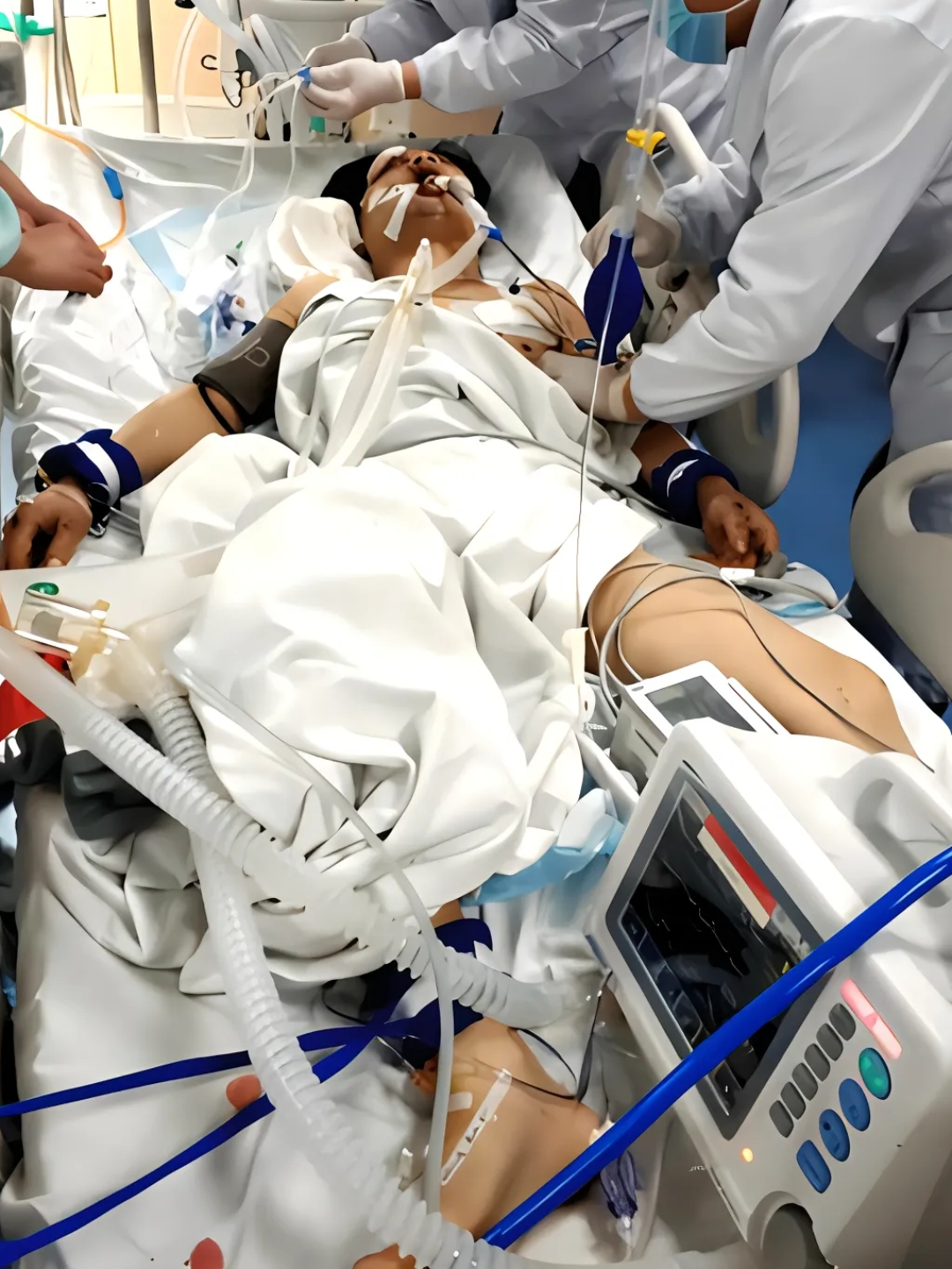 老人被紧急送进了icu抢救,听说已经花了