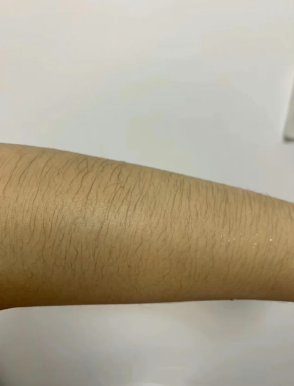 女生毛发旺盛是种什么体验?