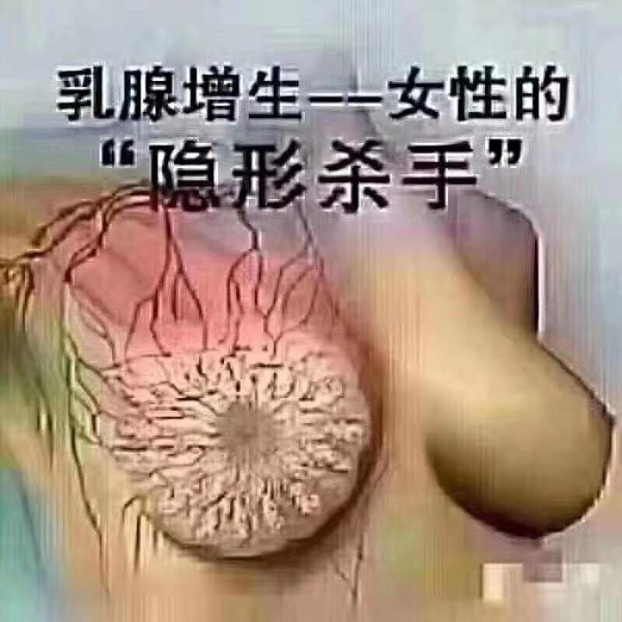 [爱心[爱心[爱心 乳房上有青筋,你不当回事 大姨妈来前胀痛,你不当