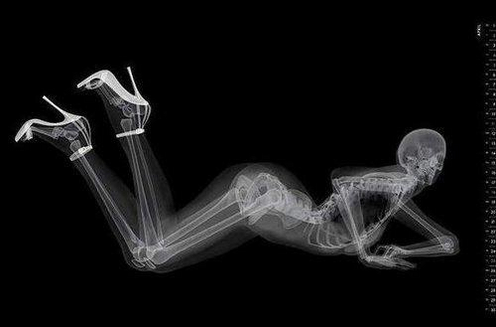 德国著名物理学家威廉·康拉德·伦琴(1845—1923年)在1895年发现了一