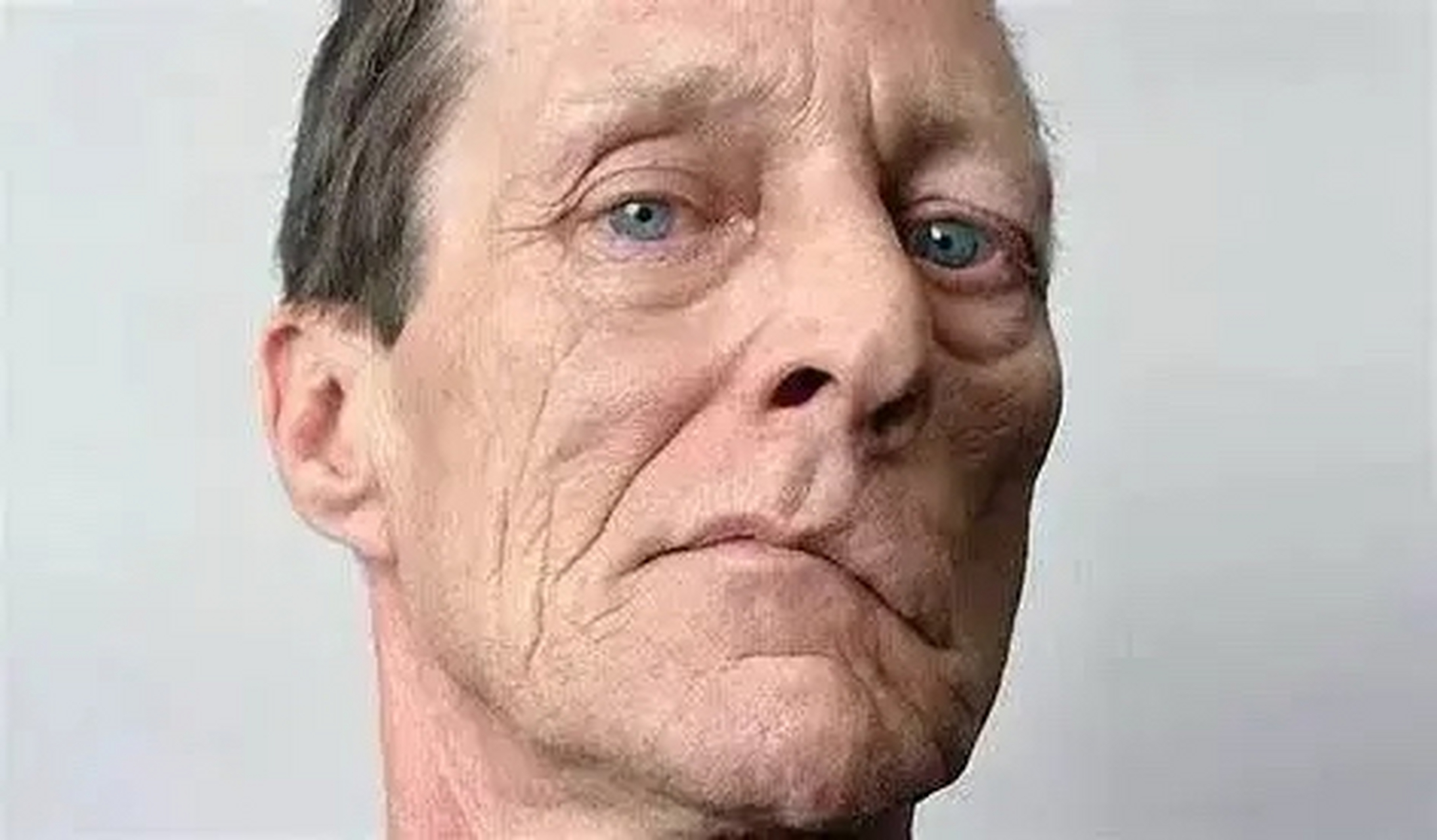 中风后口眼歪斜,一个中成药助改善!