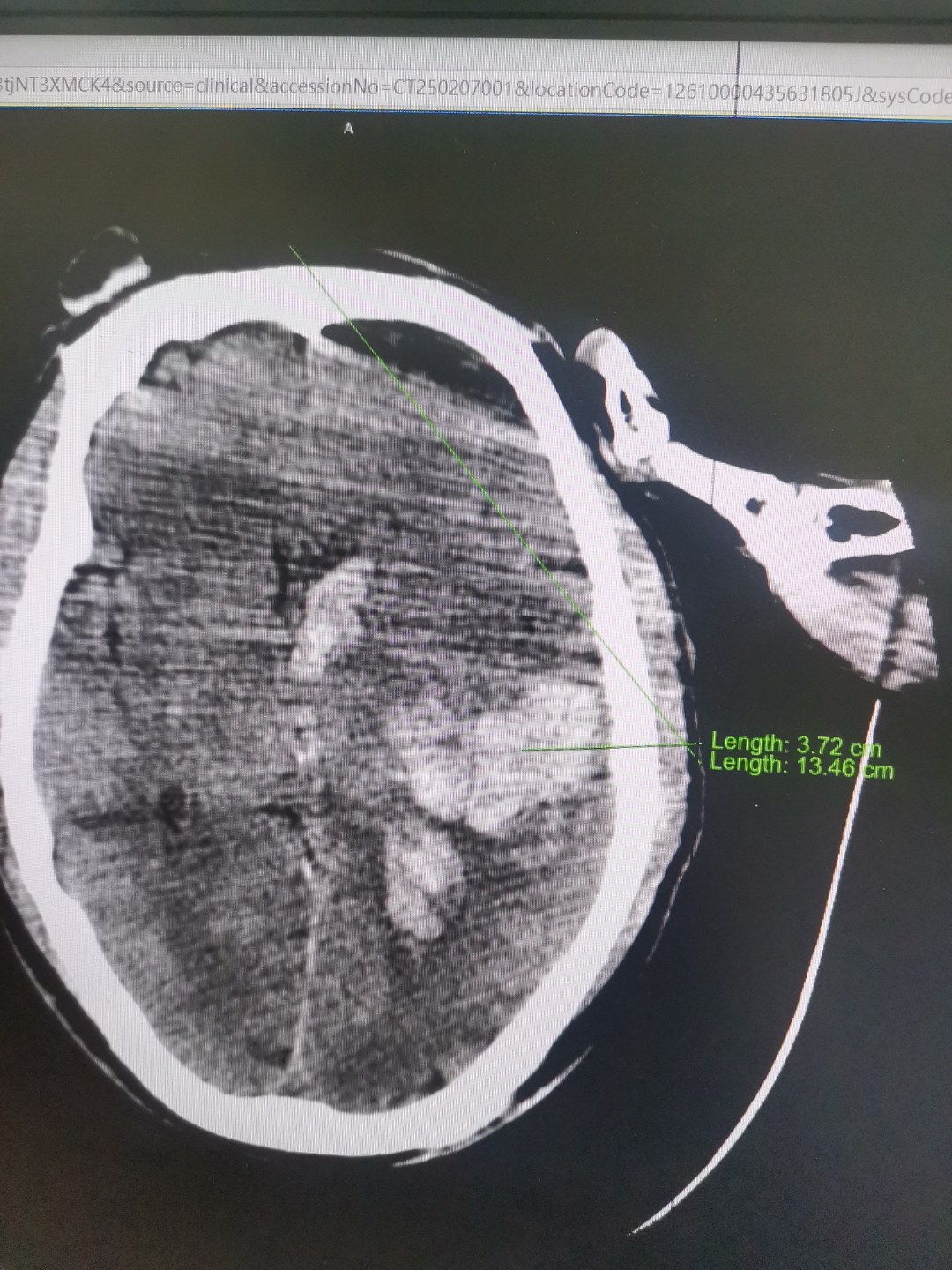 原空军总医院CT加急-空军总医院拍片子用预约吗 