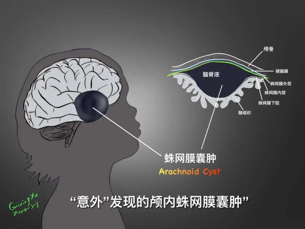 枕大池 部位图片