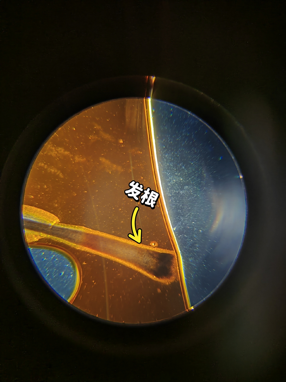 "前几天偷偷拔了妞妈一根头发,用显微镜一看,发现妞妈的发质真的是太