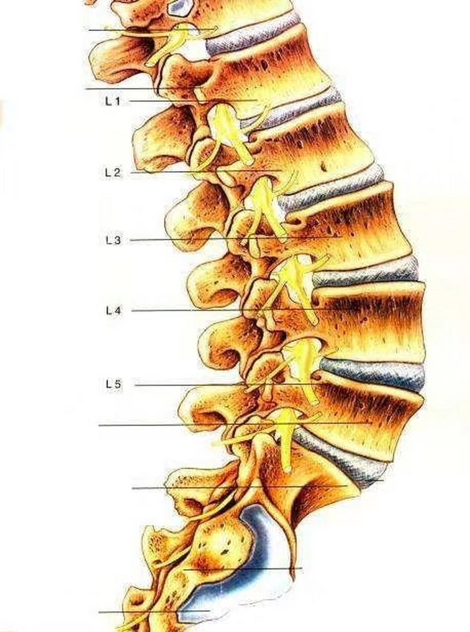 l 定义:腰椎管,侧隐窝,椎间孔因原发或继发因素造成结构异常,管腔内