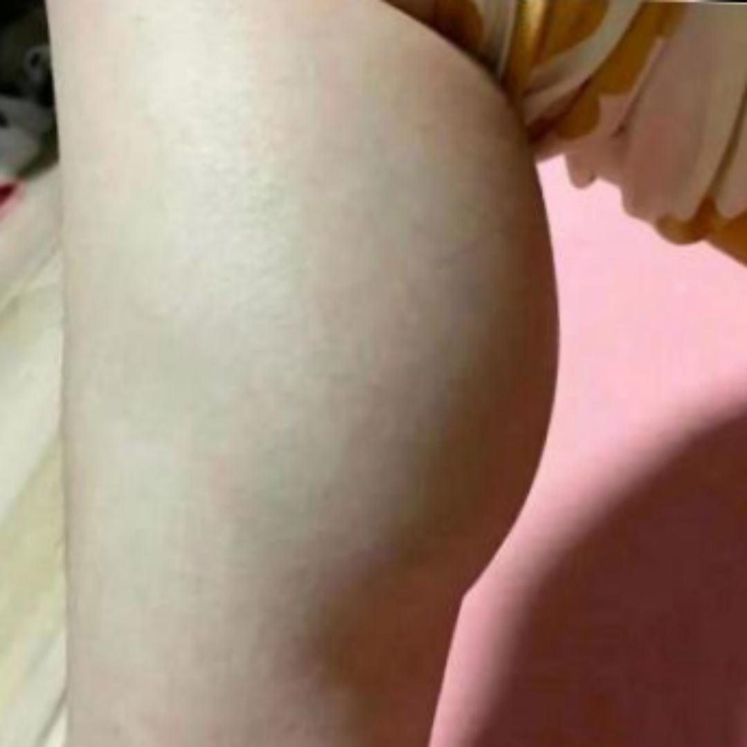 闺蜜这几天在外地出差,今天哭着致电跟我说她腿肿了.