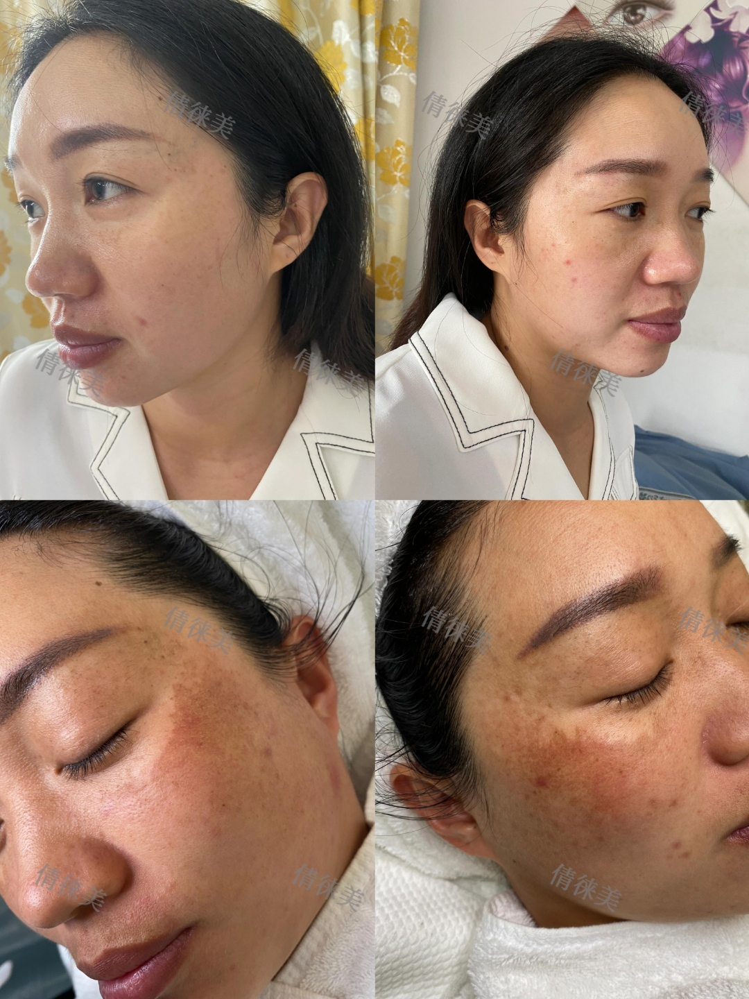 军大美容整形医院祛斑（军大美容整形医院祛斑代价
）《军大整形医院祛斑怎么样》