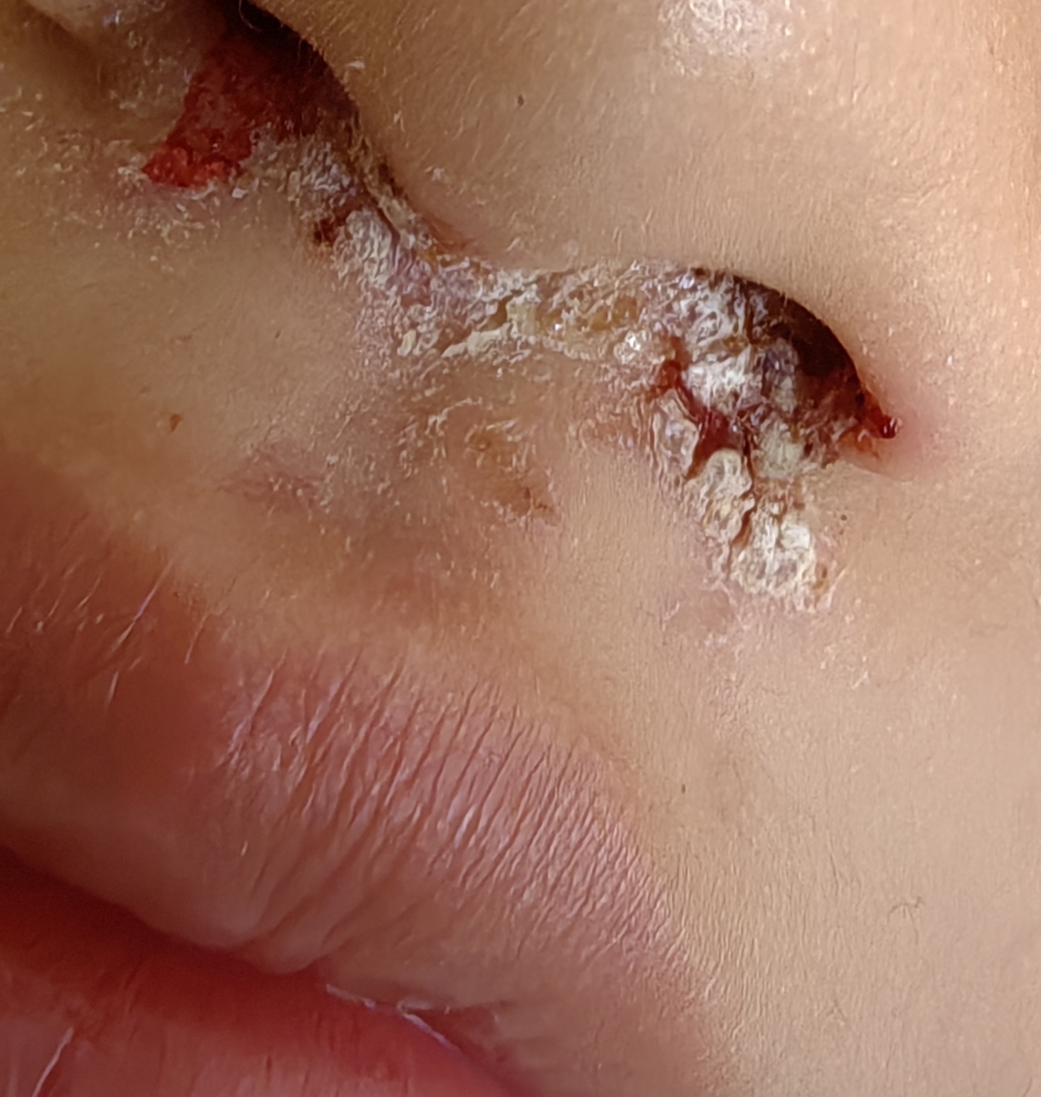 谁知道这个怎么治疗