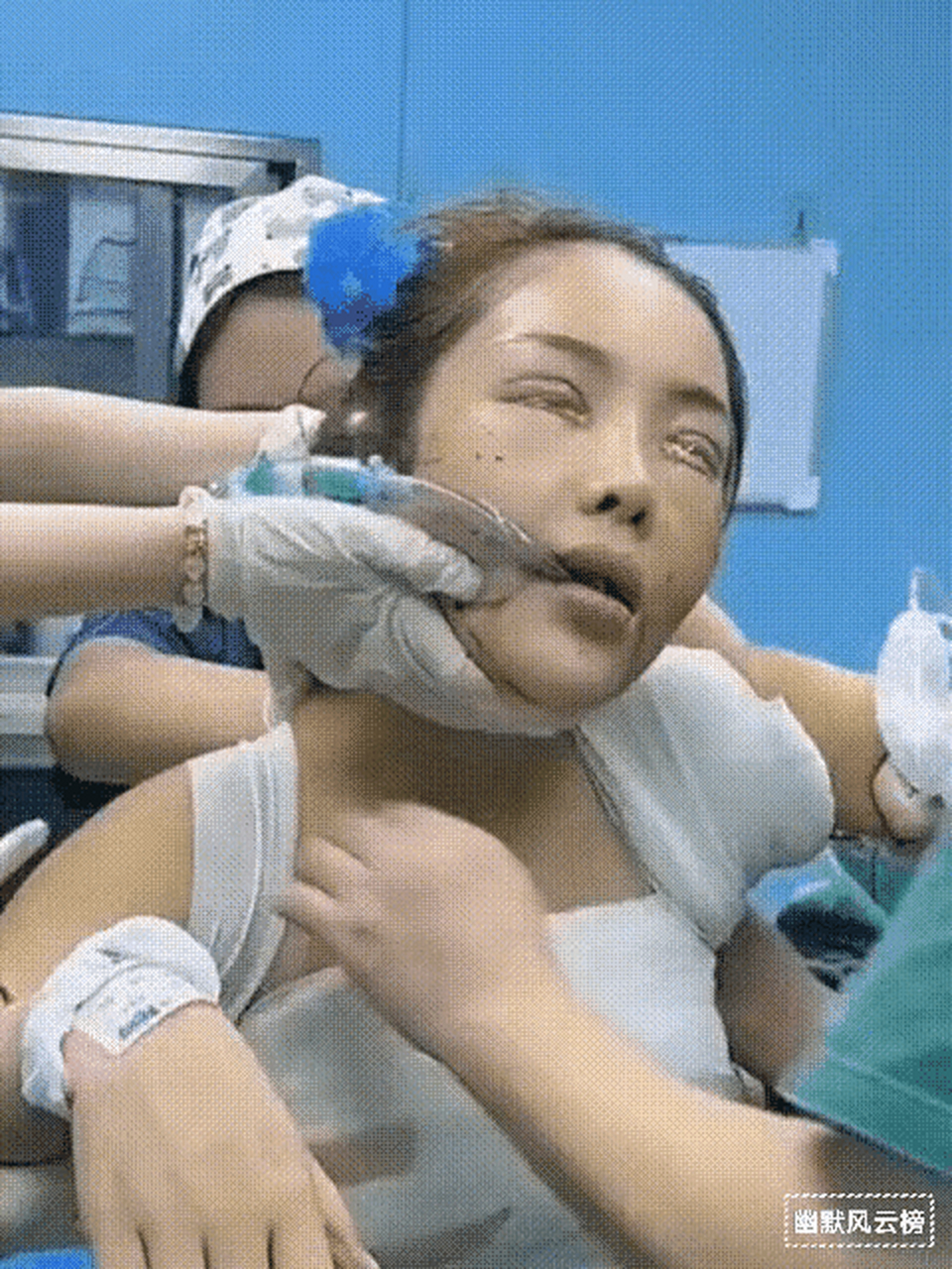 才割了双眼皮,转眼又去隆胸!真是个疯狂的小丫头!