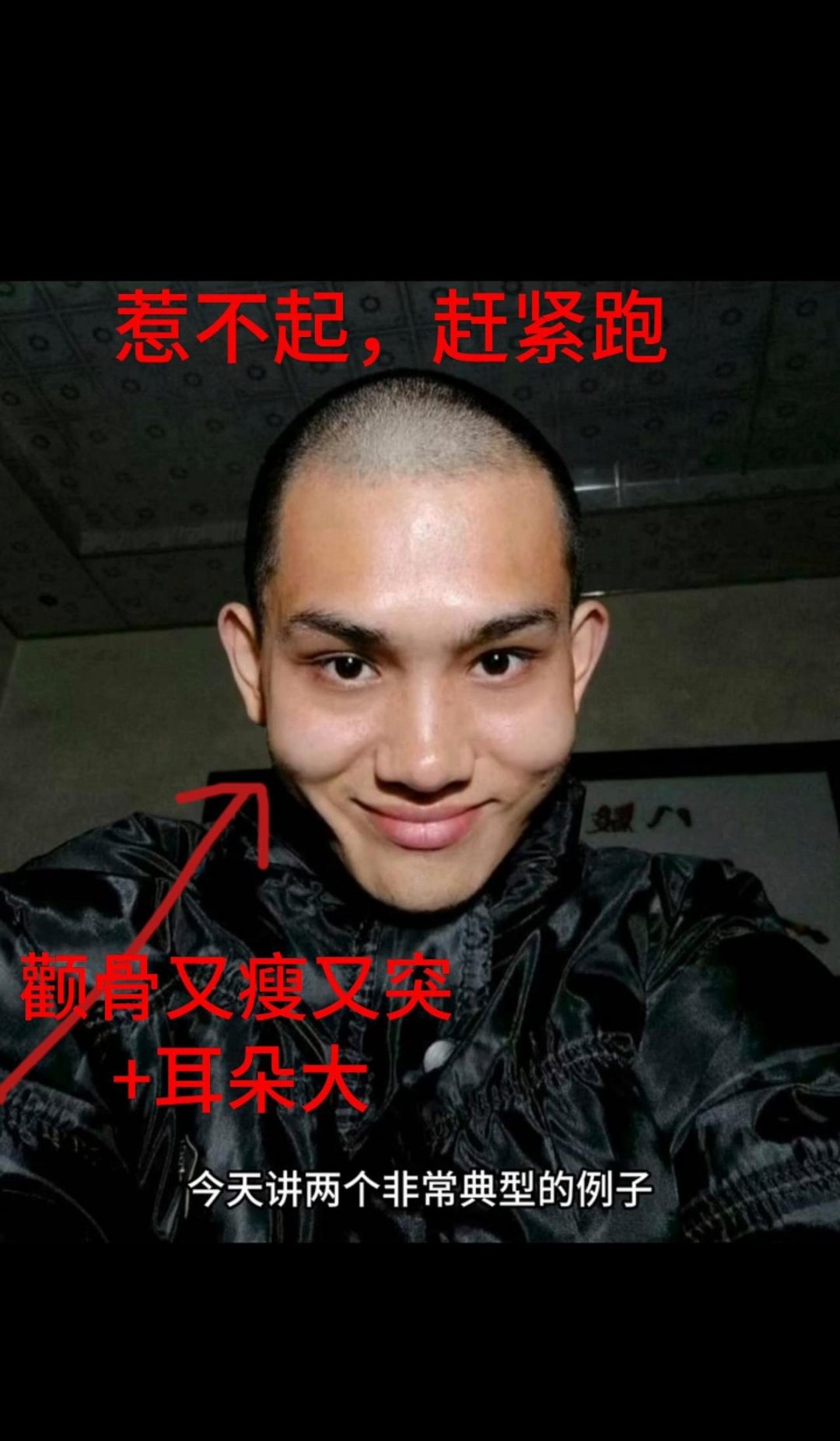 这人讲了两种长相,一种是干瘦到骨头支棱着,高颧骨