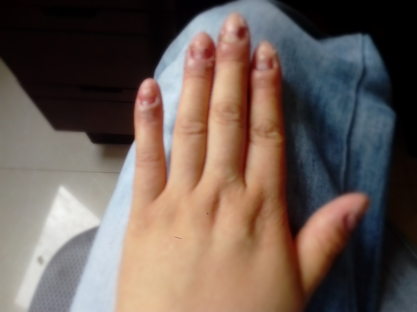 怎么会不疼呢? 十指连心疼!