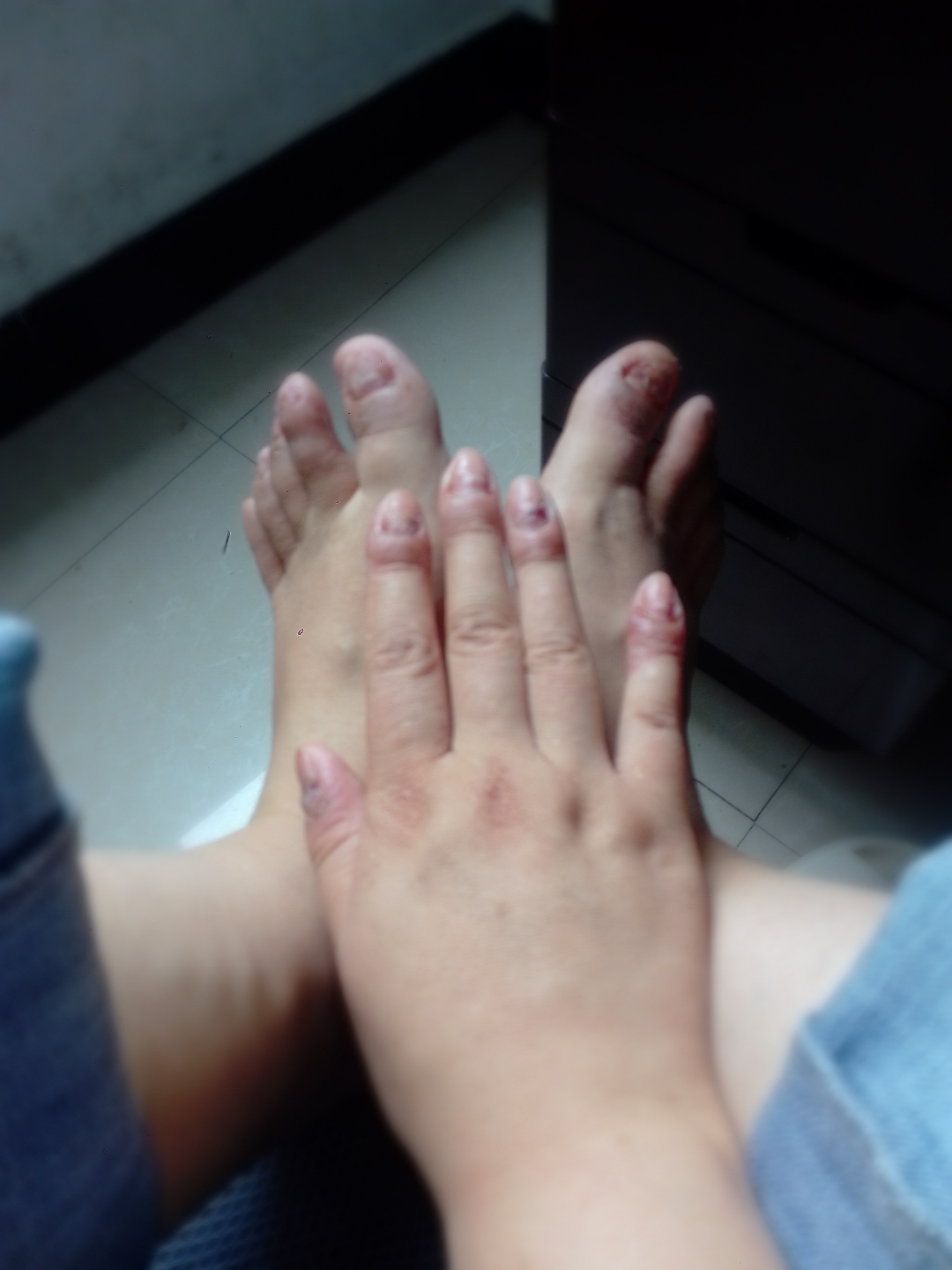 怎么会不疼呢? 十指连心疼!