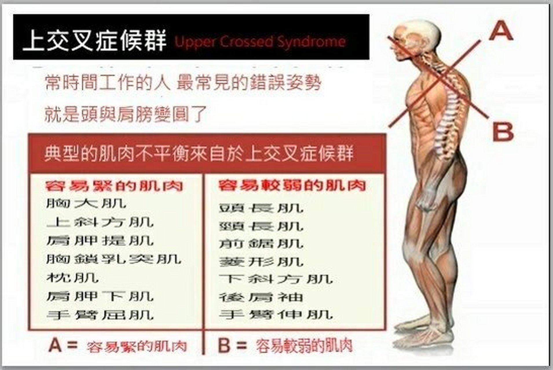 上交叉综合症图图片